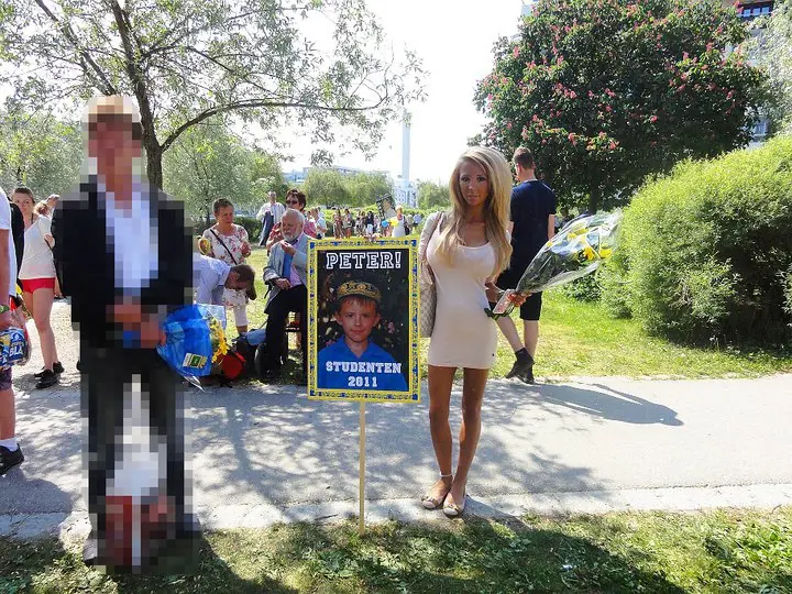 mujer de 20 años con mas cirugias