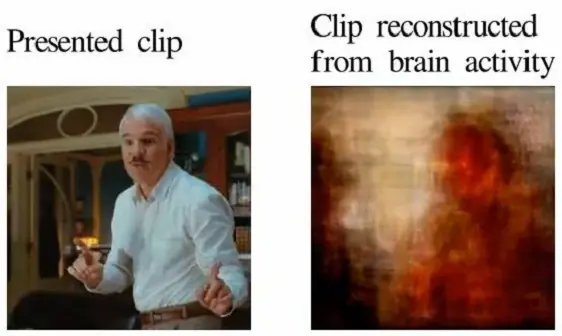 Logran reconstruir imágenes cerebrales