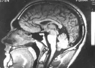 ¿Utilizamos sólo una pequeña parte de nuestro cerebro?