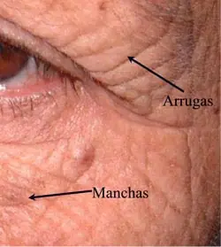 Crean píldora que desaparece arrugas