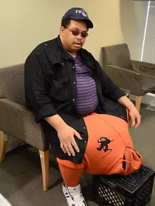Un hombre con un escroto que pesa 45 kilos !!