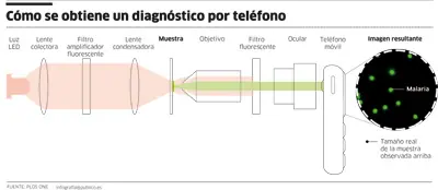 La cámara de tu TE te permitirá ver la malaria