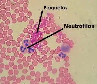 Las Plaquetas y la sangre