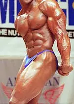 Vigorexia [Enfermedad Nutricional]