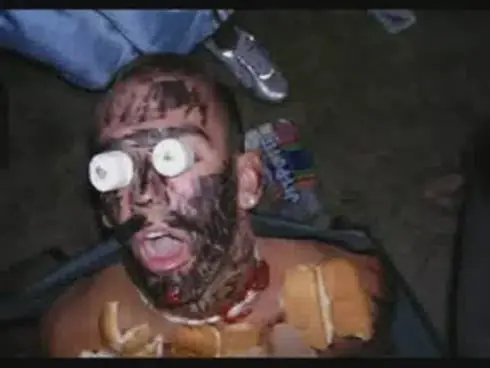 coma