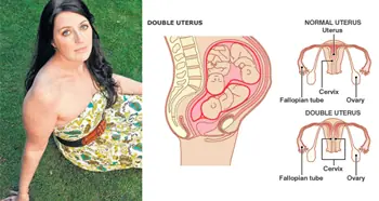 Una mujer joven y con dos vaginas