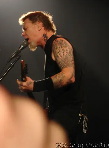 Metallica accidente de James Hetfield en 1992