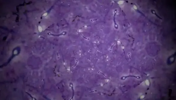 El Semen o Esperma Remedio para la Depresion
