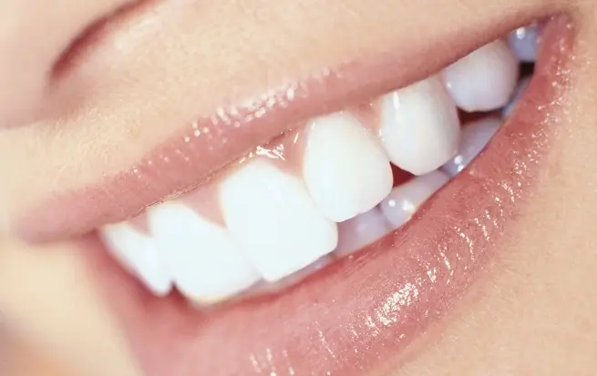 Sonrisa blanca!