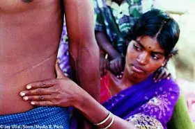 El tráfico de órganos