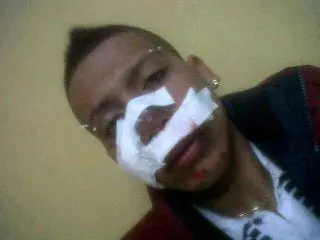 Agreden brutalmente a integrante de los Wachiturros