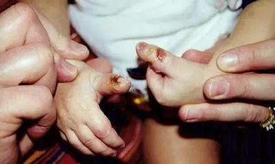Las diez anomalías más raras en Medicina
