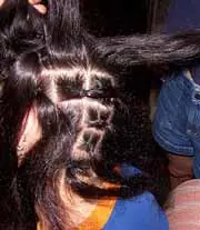 dreadlocks