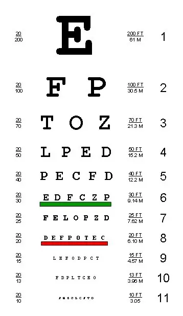 Examen de la vista
