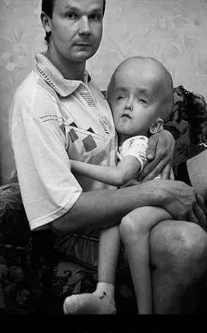 Chernobyl megapost + yapa vídeos