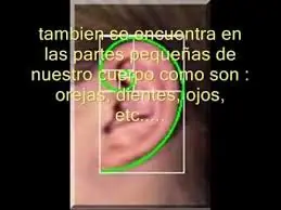 sucesion