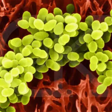 Las bacterias siguen mostrando resistencia