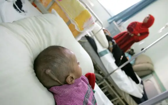 Nacen bebés en Iraq sin cerebro