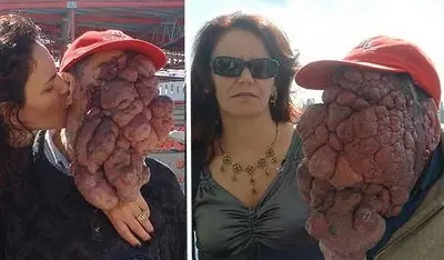 16 anormalidades de la medicina.. Agradece lo que tienes