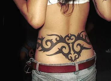 Eliminación de Tatuajes.