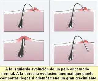Vellos o pelos encarnados