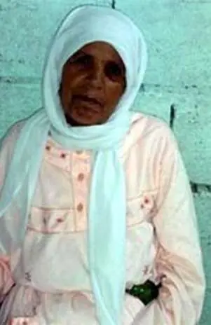 Pasó 46 años embarazada y tuvo un bebé de piedra