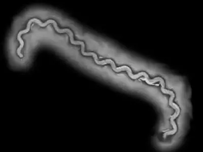 Leptospirosis