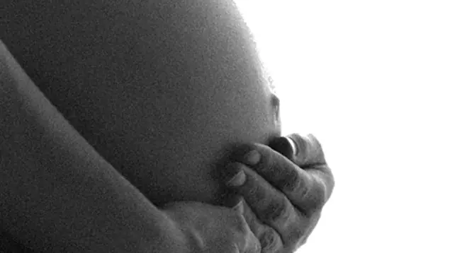 Extraen tumor de 15 kilos a boliviana embarazada