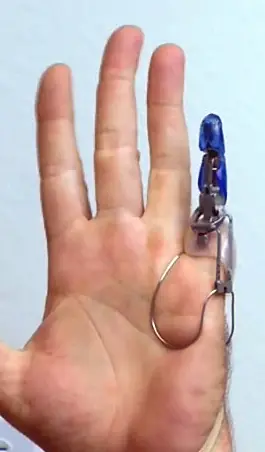 ¿Te falta un dedo? Usa el X-Finger, primer dedo biónico