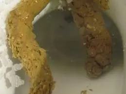 Excremento