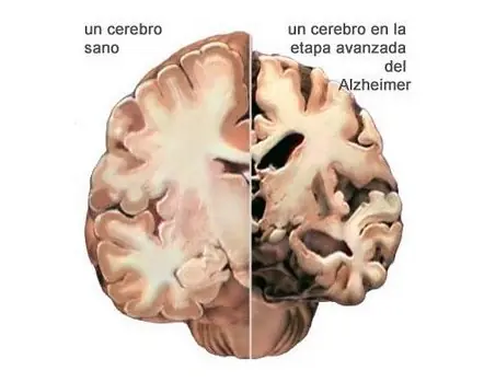 Gimnasia Cerebral