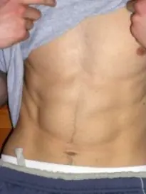Ejercicios para bajar el abdomen