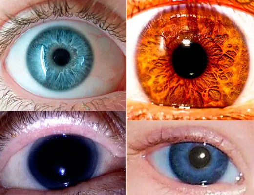 Los colores de ojos más raros en seres humanos