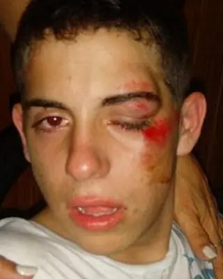 asi quedo el hijo de la hiena barrios