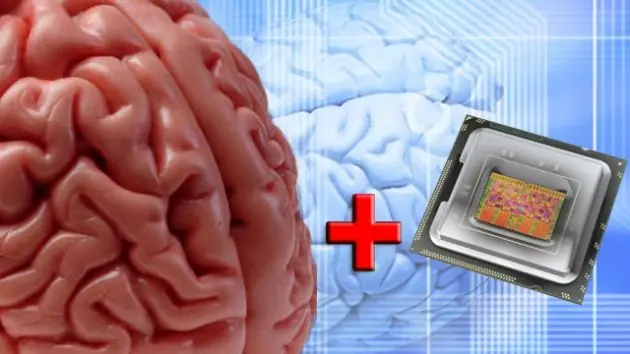 cerebro