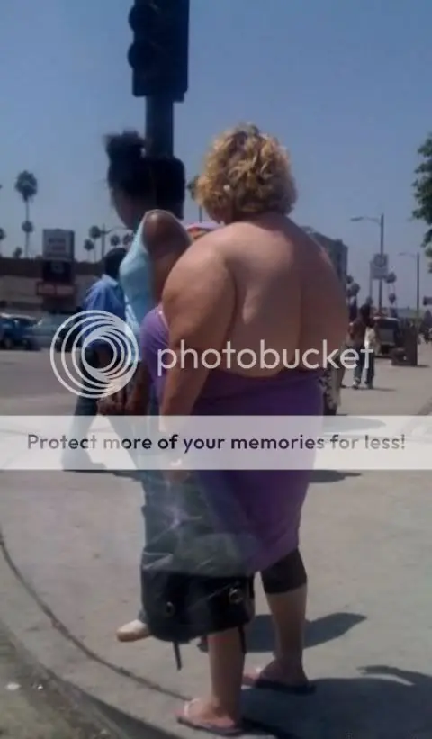 Efectos de la Cirugia Plastica