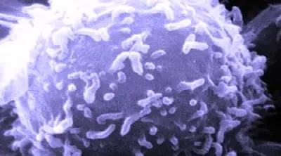 Molécula que obliga a células cancerígenas a suicidarse