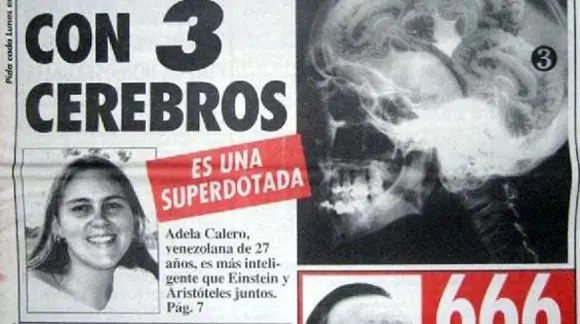 Adela: La mujer que tiene 3 cerebros