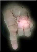 Mudras, curación con las manos.