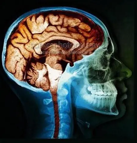 La Ciencia del Cerebro Humano , Sistemas Nervioso - Megapost