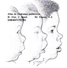 Otra forma de explicar que es el Sindrome de Williams