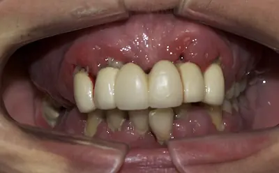 Tratamiento dental que cura la depresión