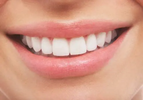 ¿Dientes amarillos? Proba con estos remedios caseros