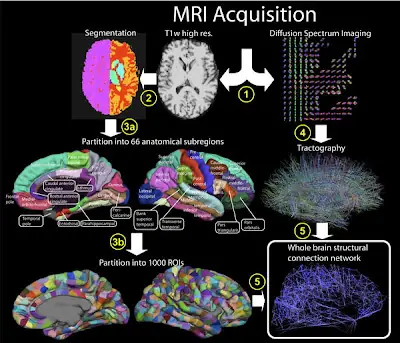 primer mapa 3D completo del cerebro humano