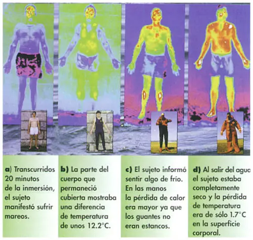 Hipotermia