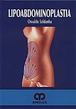 Lipoabdominoplastia