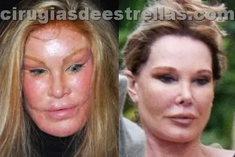 Las 5 personas mas Adictas a las Cirugias del mundo...