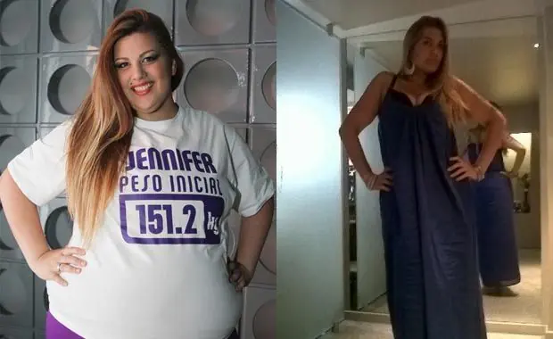 La transformación de Jenny, después del tratamiento en Cue
