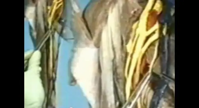 videos de diseccion de anatomia humana en español completo