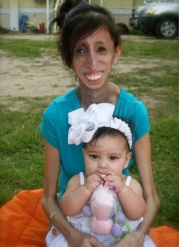 Lavida extraordinaria de Lizzie Velasquez.